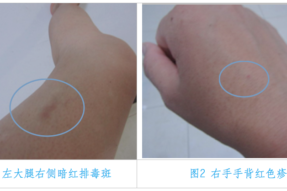 认真做好管理员，身体现排毒
